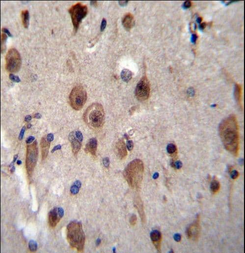 LRRC28 Antibody (aa314-342)