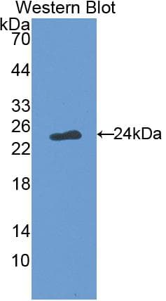 FASLG / Fas Ligand Antibody (aa102-280, PE)