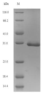 Human SRR / Serine Racemase Protein (Recombinant 6His-SUMO, N-terminus)