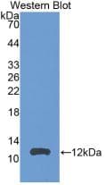 CCL24 / Eotaxin 2 Antibody (aa27-119, Cy3)