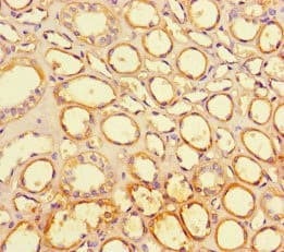 Polyclonal Rabbit anti-Human PPIL5 Antibody (IHC, IF)