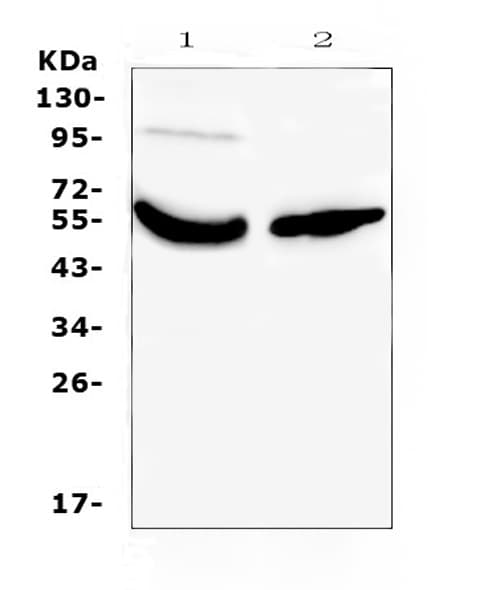 GC / Vitamin D-Binding Protein Antibody
