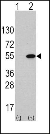 ATF4 Antibody (Ser245)