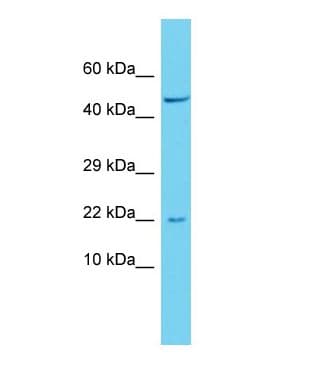 PTGES3 / p23 Antibody (N-Terminus)