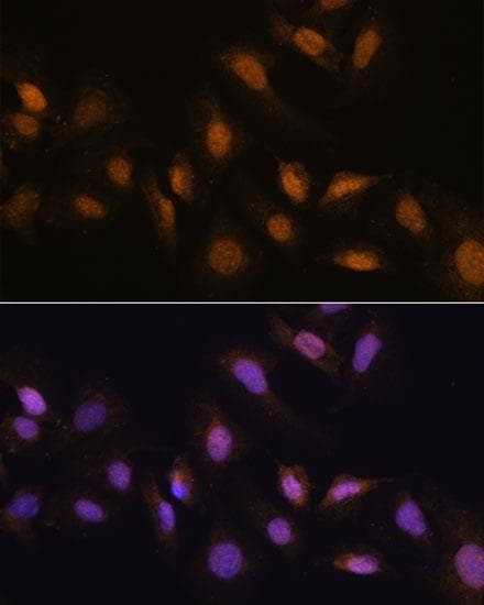 RBM39 Antibody