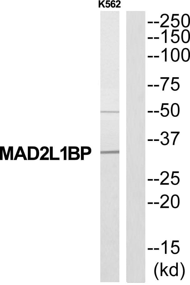 Polyclonal Rabbit anti-Human CMT2 / MAD2L1BP Antibody (WB)