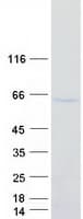 Human FOXQ1 Protein (Recombinant Myc-DDK (Flag))