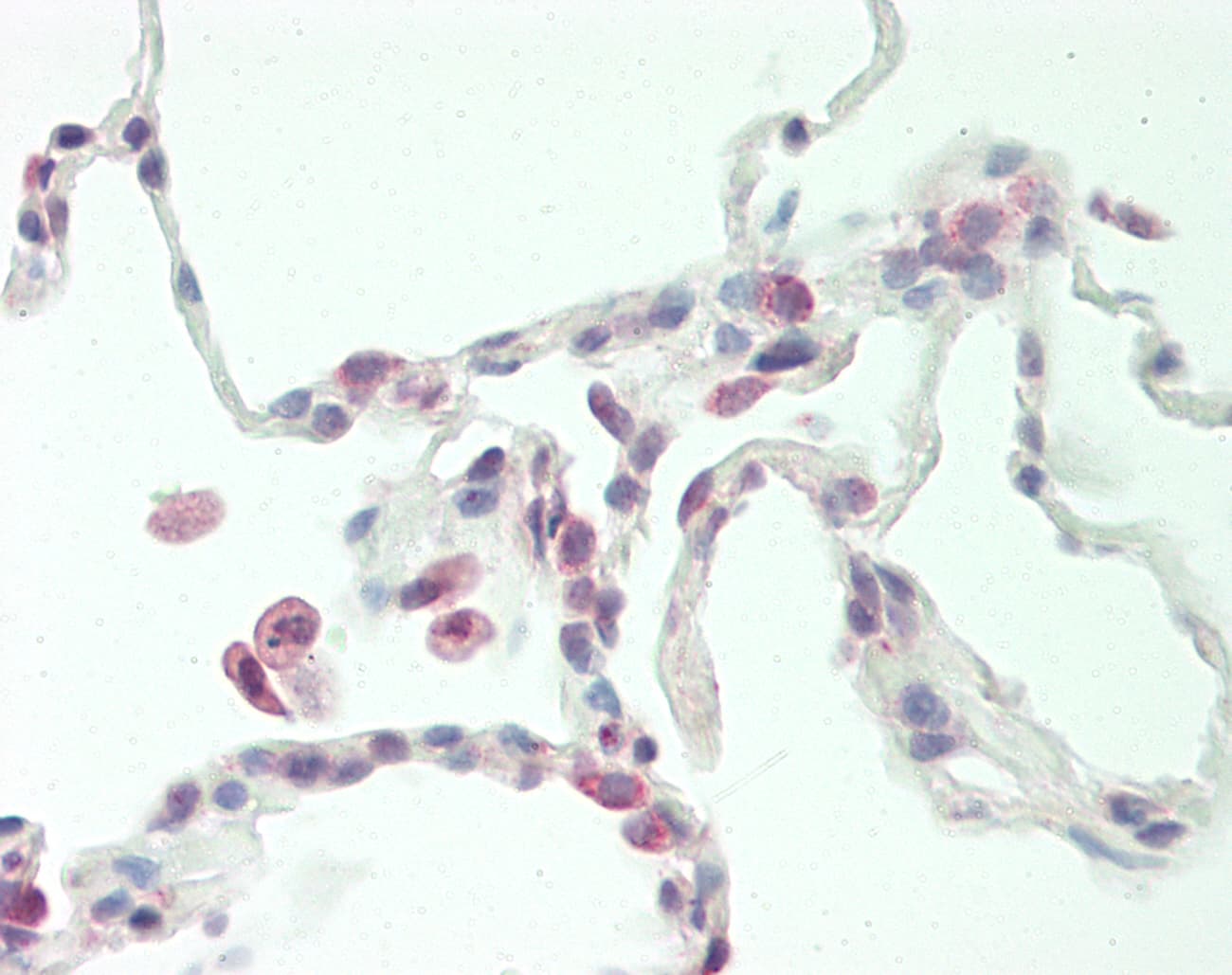Polyclonal Rabbit anti-Human PRELP / Prolargin Antibody (aa251-300, IHC, WB)