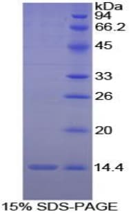 Chicken IL8 / Interleukin 8 Protein (Recombinant His)