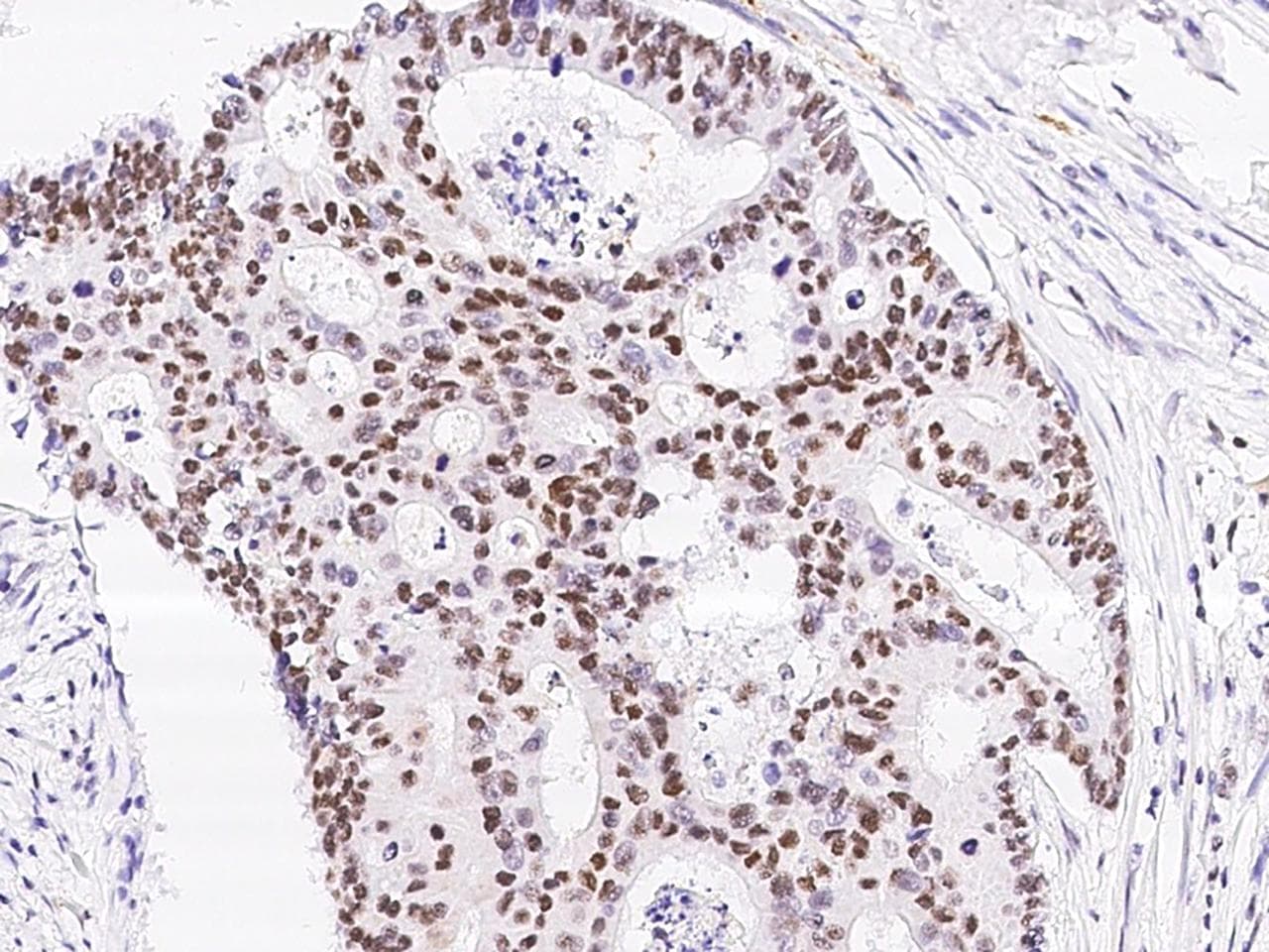 TCF12 / HEB Antibody