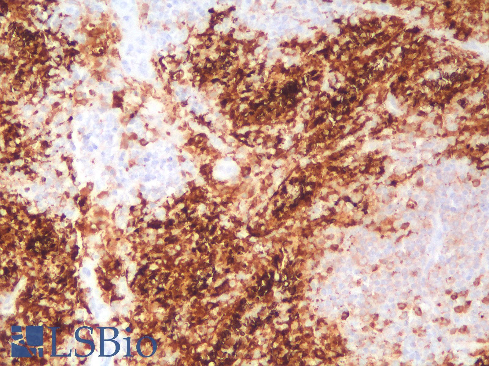 PathPlus™ Recombinant Monoclonal Rabbit anti-Human FTL / Ferritin Light Chain Antibody (clone FTL/2338R, aa 38-165, IHC, WB)