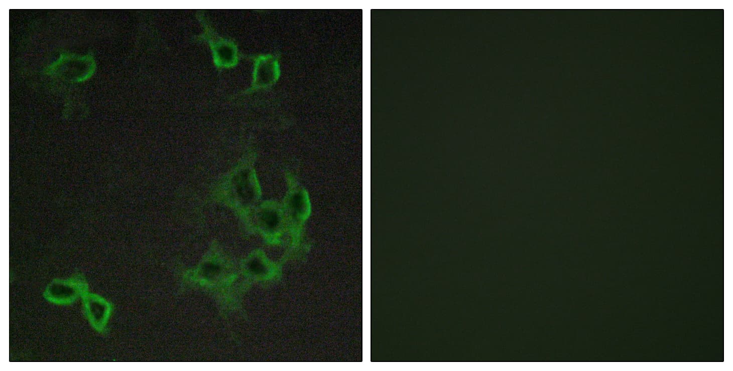 ACKR4 / CCRL1 / CCR11 Antibody (aa5-54)