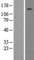 TAF2 Protein (Over-Expression Lysate Myc-DDK (Flag))