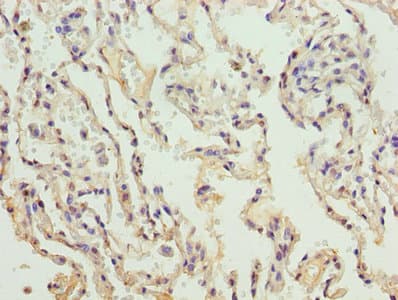 COL4A3 / Tumstatin Antibody (aa1427-1668)
