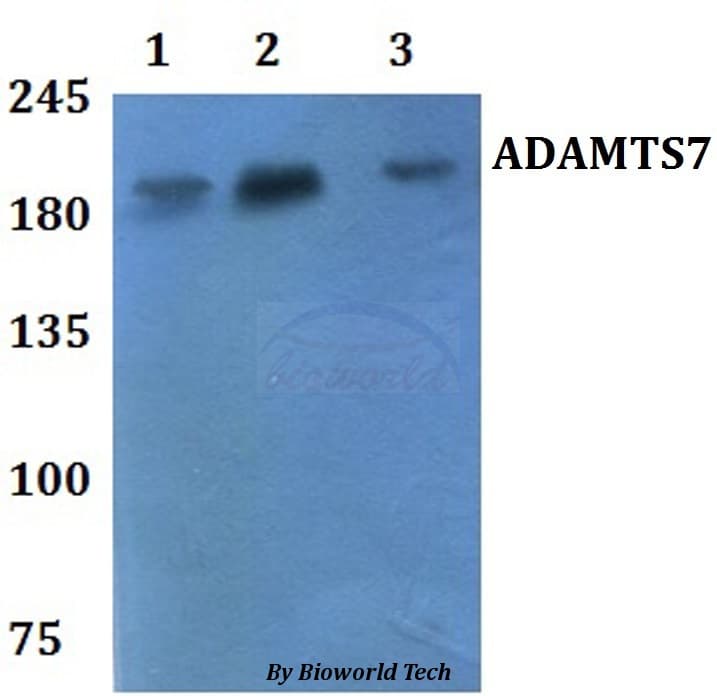 Polyclonal Rabbit anti-Human ADAMTS7 Antibody (IHC, WB)