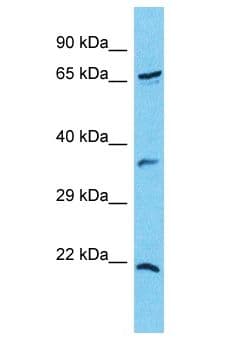 CXorf23 Antibody (aa141-190)