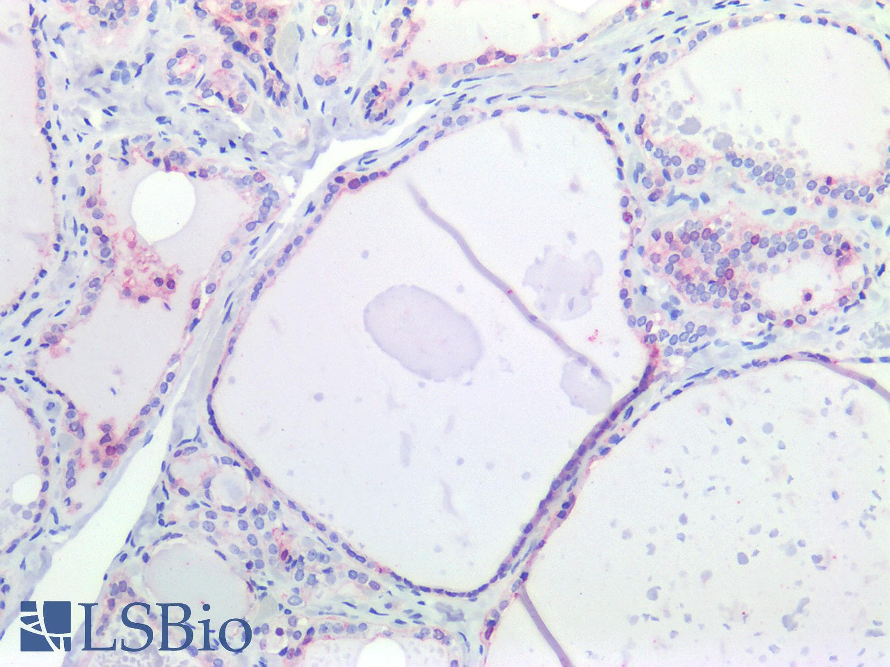 IHC-plus™ Monoclonal Mouse anti-Human OCLN / Occludin Antibody (clone OC-3F10, C-Terminus, IHC, IF, WB)