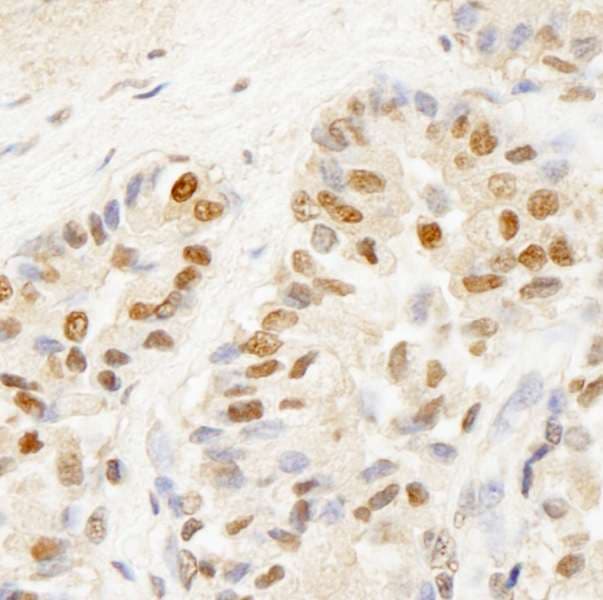 Polyclonal Rabbit anti-Human BRF1 Antibody (aa627-677, IHC)