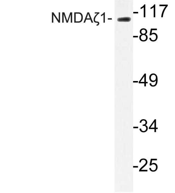 GRIN1 / NMDAR1 Antibody (Phe891)
