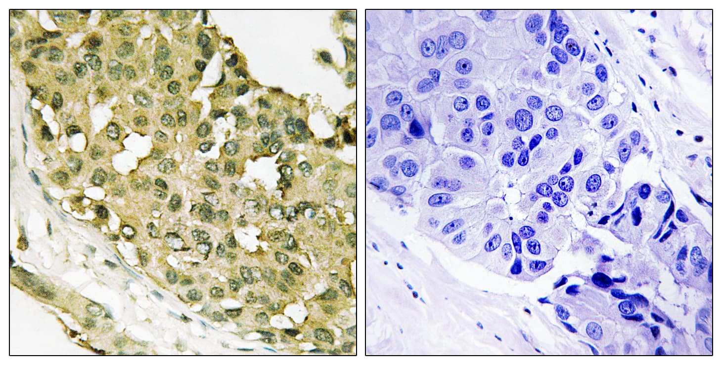 STMN1 / Stathmin / LAG Antibody (phospho-Ser62)