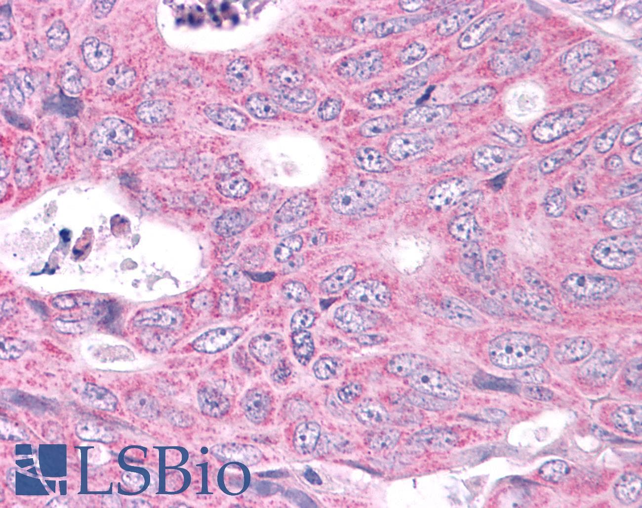 PathPlus™ NEK6 Antibody (C-Terminus)