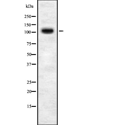 TOPORS Antibody