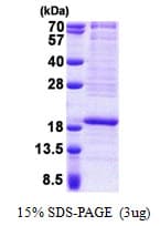 Human RPL22 / Ribosomal Protein L22 (Recombinant His)