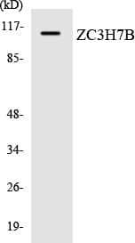 Polyclonal Rabbit anti-Human ZC3H7B Antibody (aa826-875, WB)