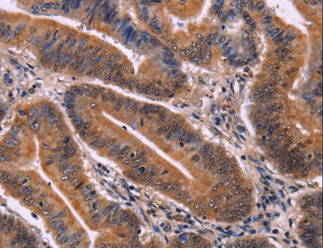 Polyclonal Rabbit anti-Human CDC5 / CDC5L Antibody (IHC)