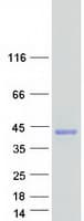 Human VSTM1 Protein (Recombinant Myc-DDK (Flag))