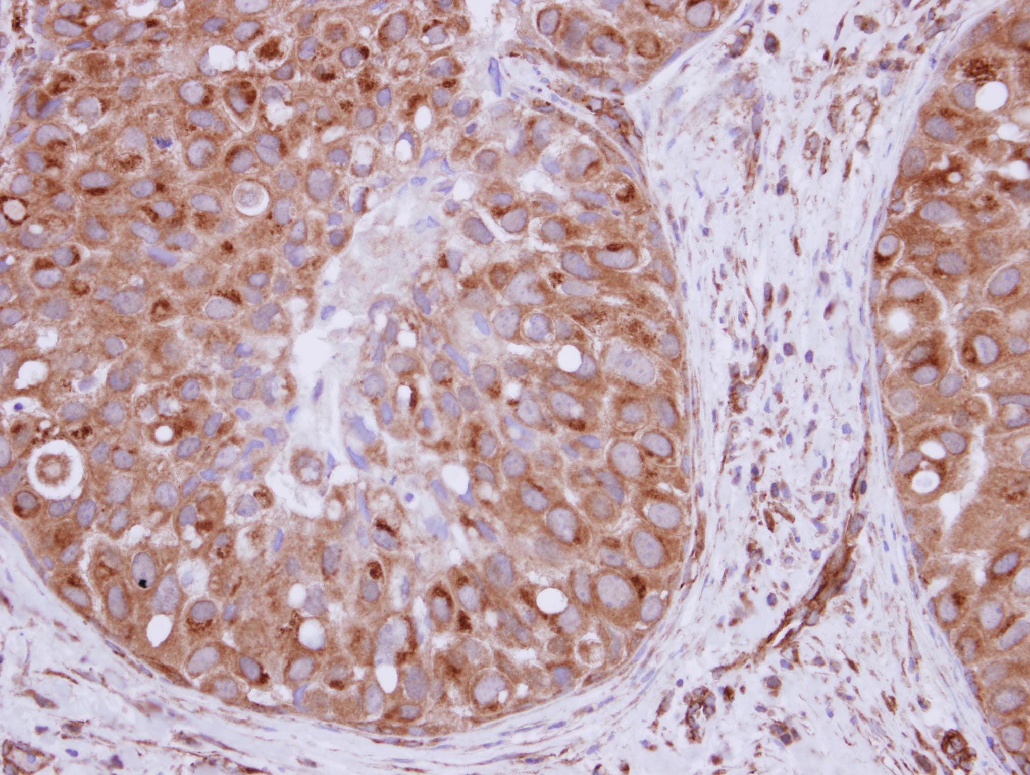 XPO6 Antibody