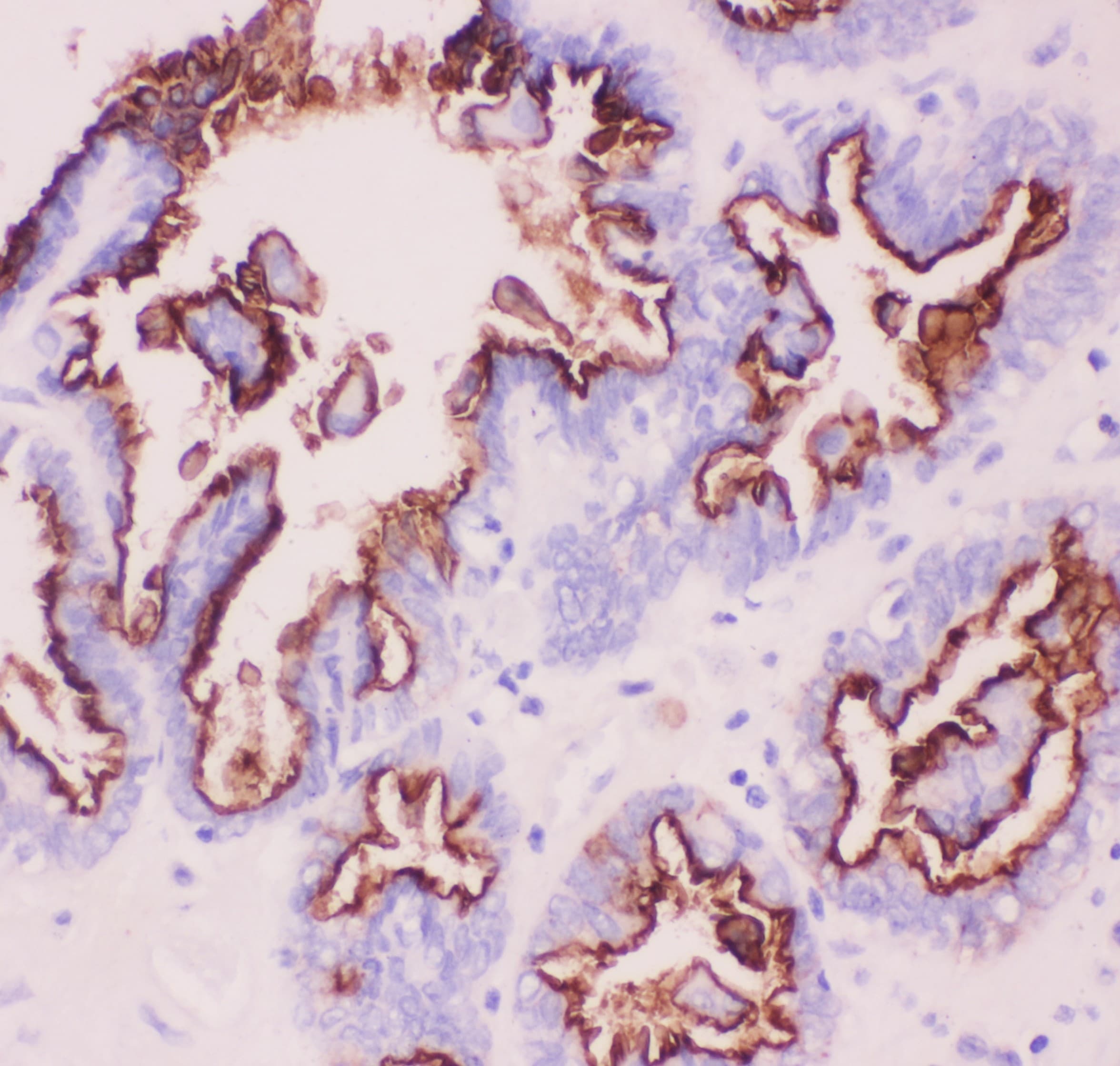 EMA / MUC1 Antibody (aa935-1097)