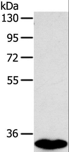 Polyclonal Rabbit anti-Human SULT1B1 / Sulfotransferase 1B1 Antibody (IHC, WB)