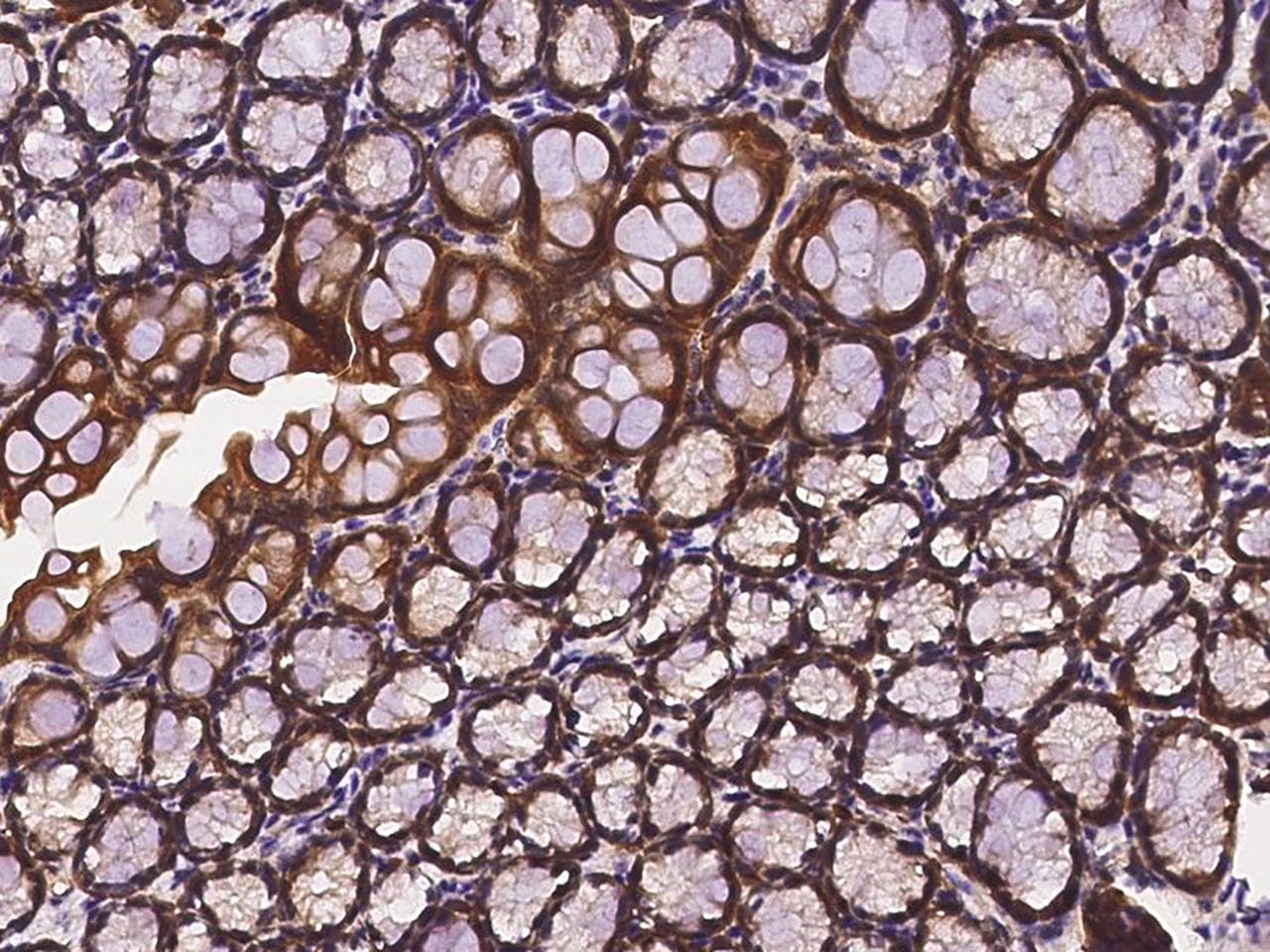 PFN1 / Profilin 1 Antibody