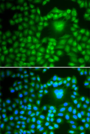 IHC-plus™ Polyclonal Rabbit anti-Human PPP1CB Antibody (IHC, IF, WB)