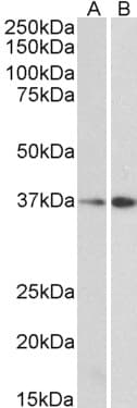 IHC-plus™ MORF4L1 / MRG15 Antibody (aa2-14)