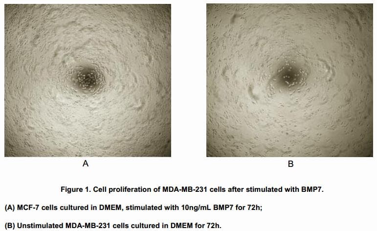 Mouse IL2RA / CD25 Protein (Recombinant His, N-Terminal)