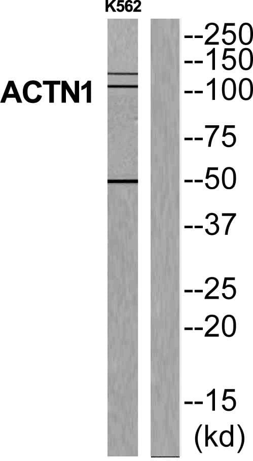 ACTN1 Antibody