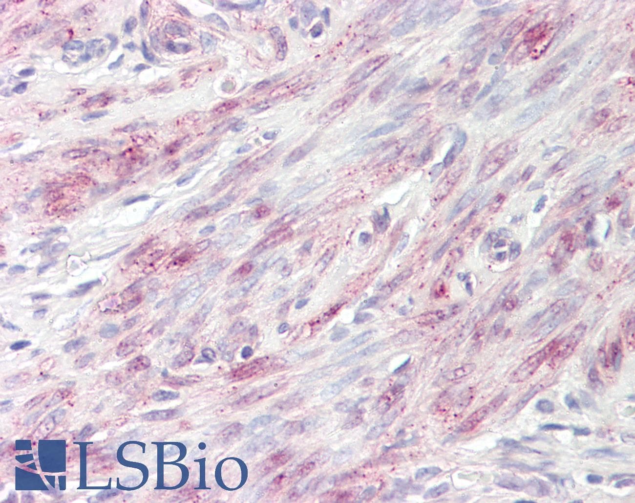 Polyclonal Rabbit anti-Human BABAM1 / HSPC142 Antibody (aa36-85, IHC, WB)