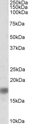 PathPlus™ SNCA / Alpha-Synuclein Antibody (aa97-110)