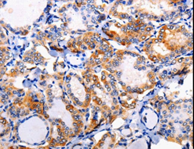 AP1B1 / BAM22 Antibody