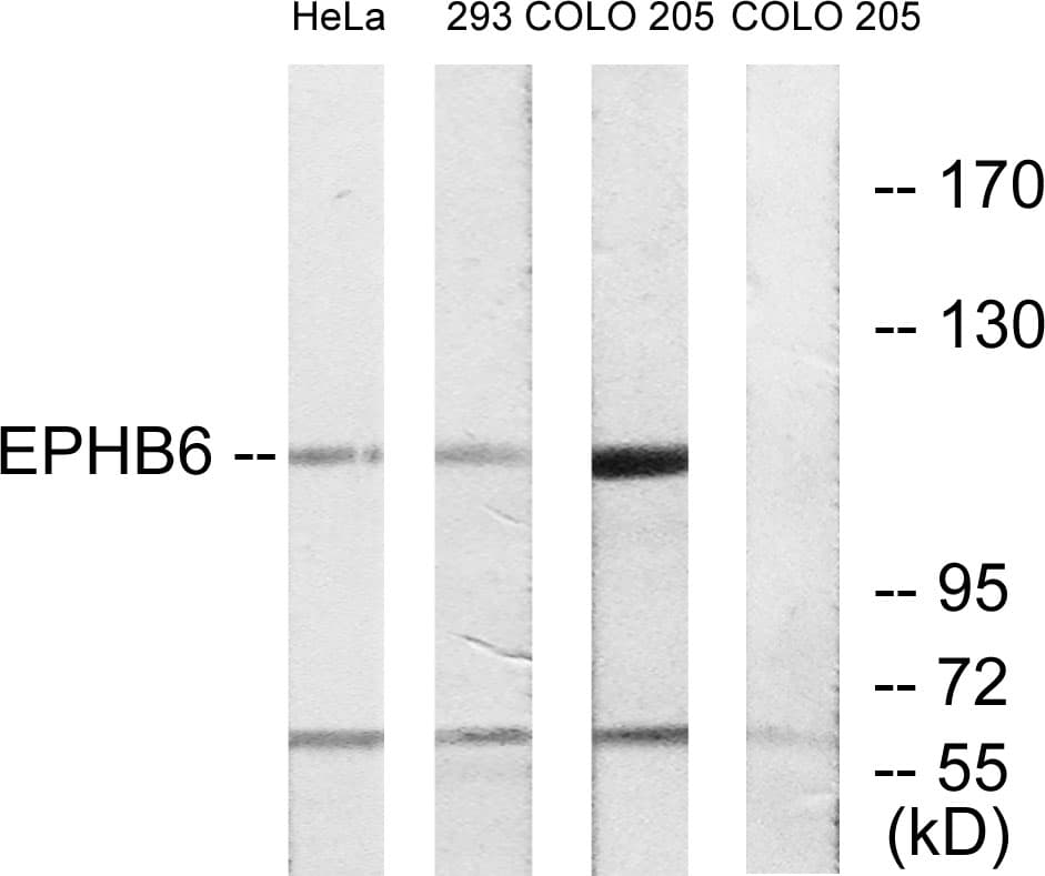 IHC-plus™ EPHB6 / EPH Receptor B6 Antibody (aa861-910)