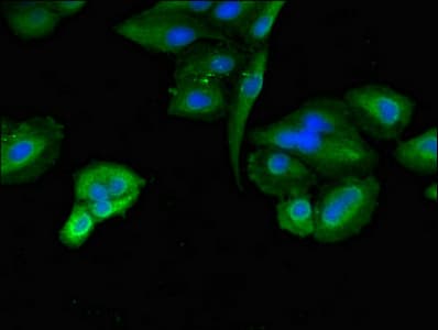 TLK2 Antibody