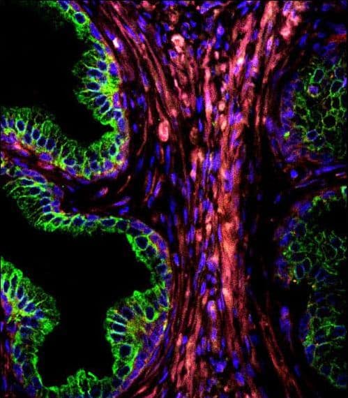 IHC-plus™ KRT18 / CK18 / Cytokeratin 18 Antibody (aa401-430)