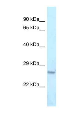 Polyclonal Rabbit anti-Mouse OVOL2 Antibody (aa51-100, WB)
