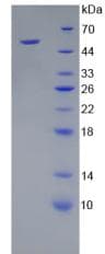 Mouse KLK8 / Kallikrein 8 Protein (Recombinant His-GST)