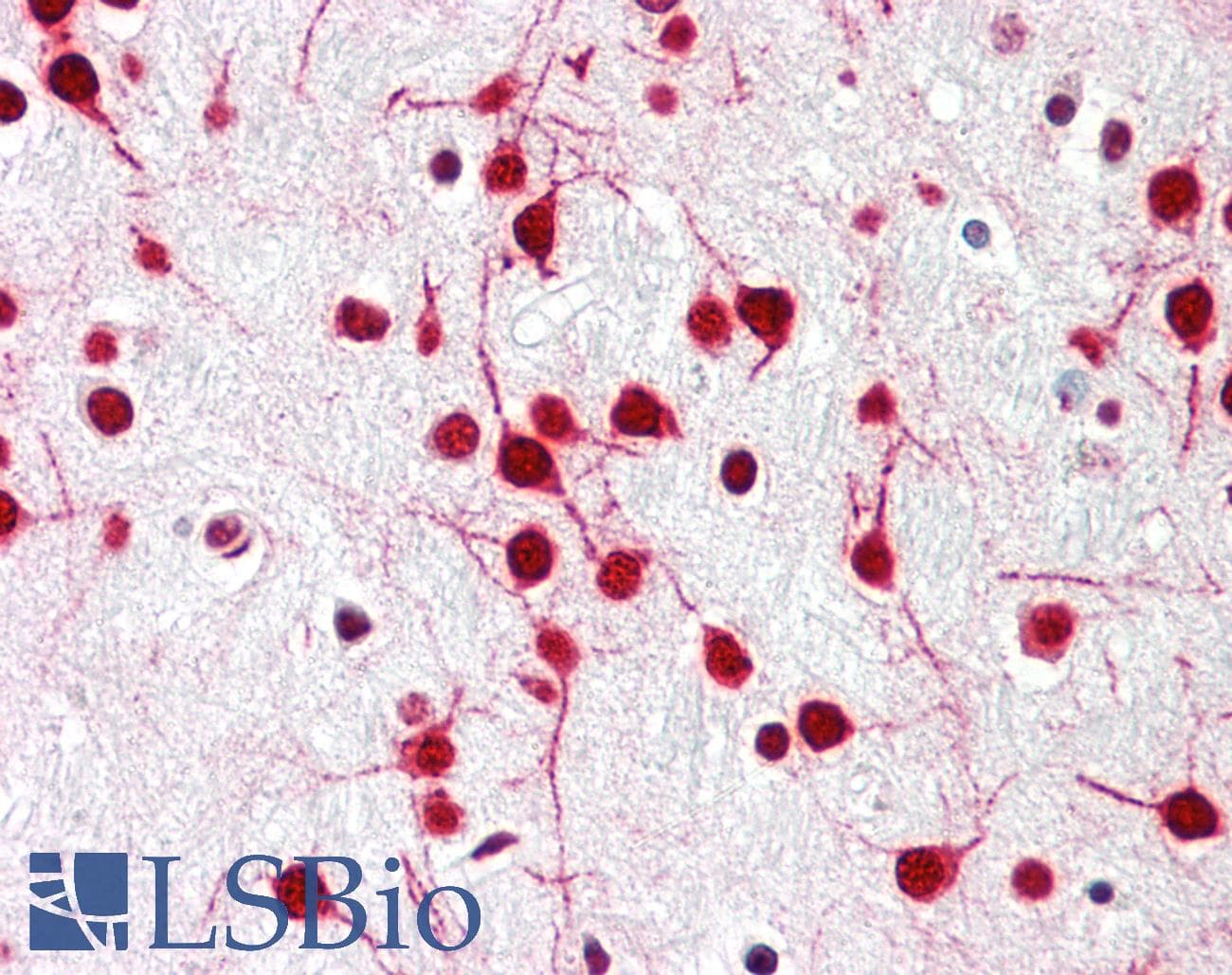 IHC-plus™ KIAA0141 Antibody