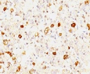 FSHB / FSH Beta Antibody (clone FSHb/1062)