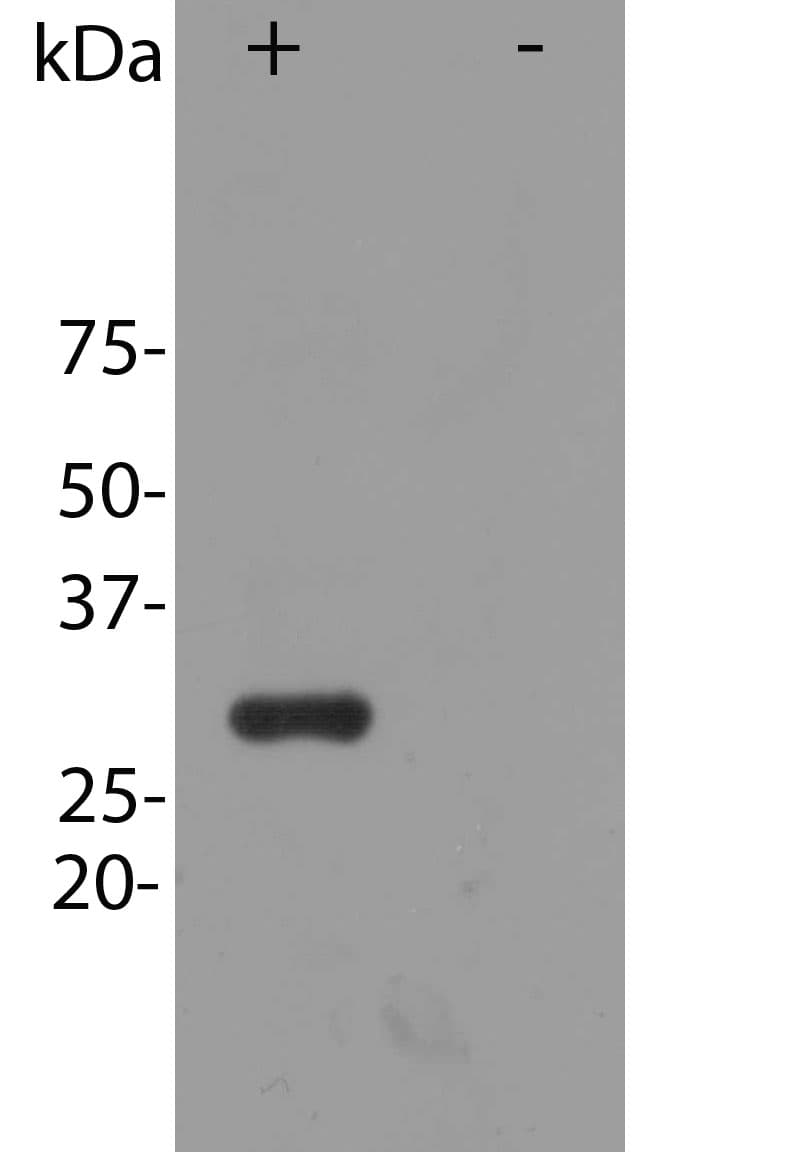 Polyclonal Rabbit anti-Discosoma mCherry Antibody (IF, WB)