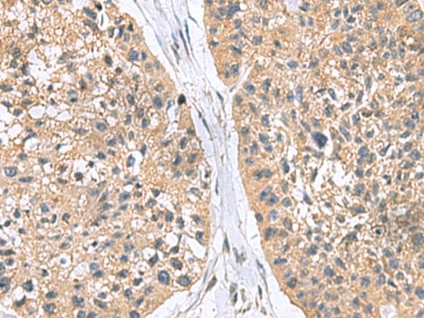 RGS2 Antibody